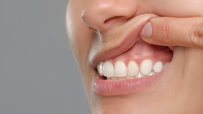 Как укрепить десны?